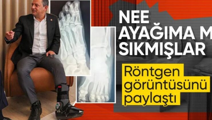 Özel ayak röntgen filmlerini paylaştı